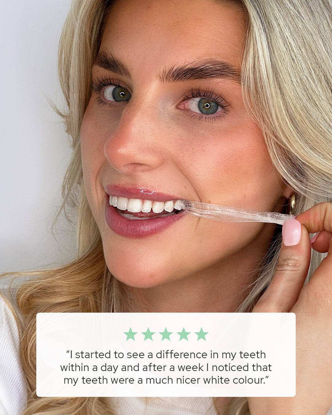 5 star review of ultra teeth whitening strips - 7 day treatment